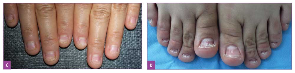 Are Your Nail Problems Related Your Health? Find Out In 1 Minute!