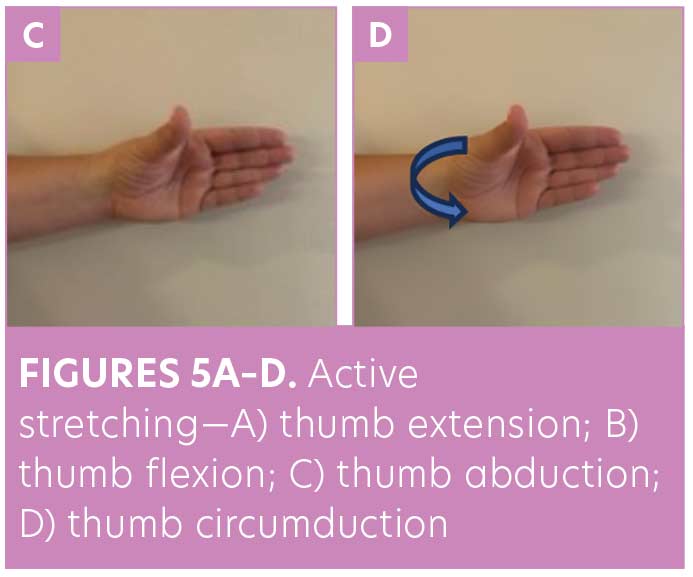 Carpal Tunnel Syndrome Therapeutic Exercise Program - OrthoInfo - AAOS